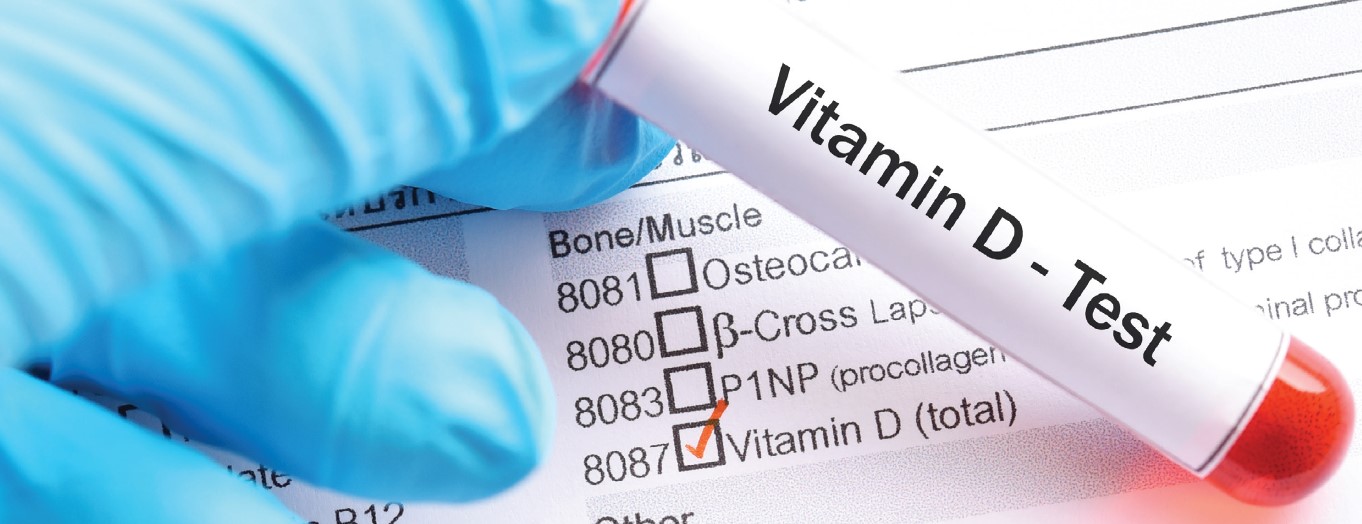 Vitamin D Supplementation and the Prevention of Nutritional Rickets