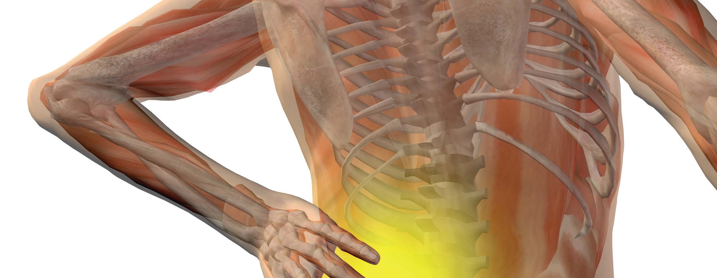 We’ve Got Your Back: Current Management of Acute Low Back Pain