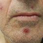ep 6. Lips what should we be thinking about