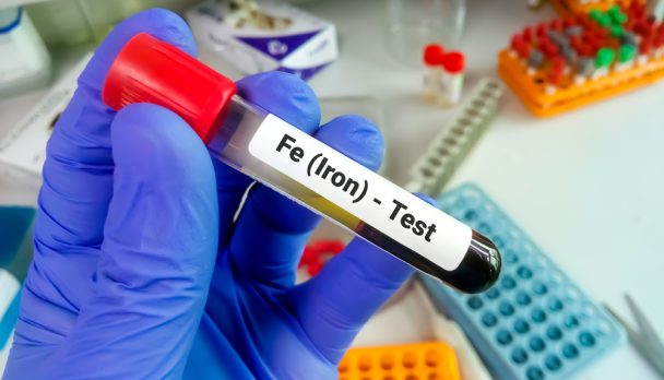 Bicochemist ferritin test