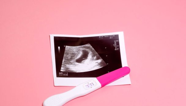 Photo,Of,Ultrasound,And,Pregnancy,Test,On,A,Pastel,Pink