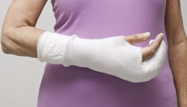 Closeup,Of,Senior,Woman's,Arm,In,A,Bandage,And,Cast.